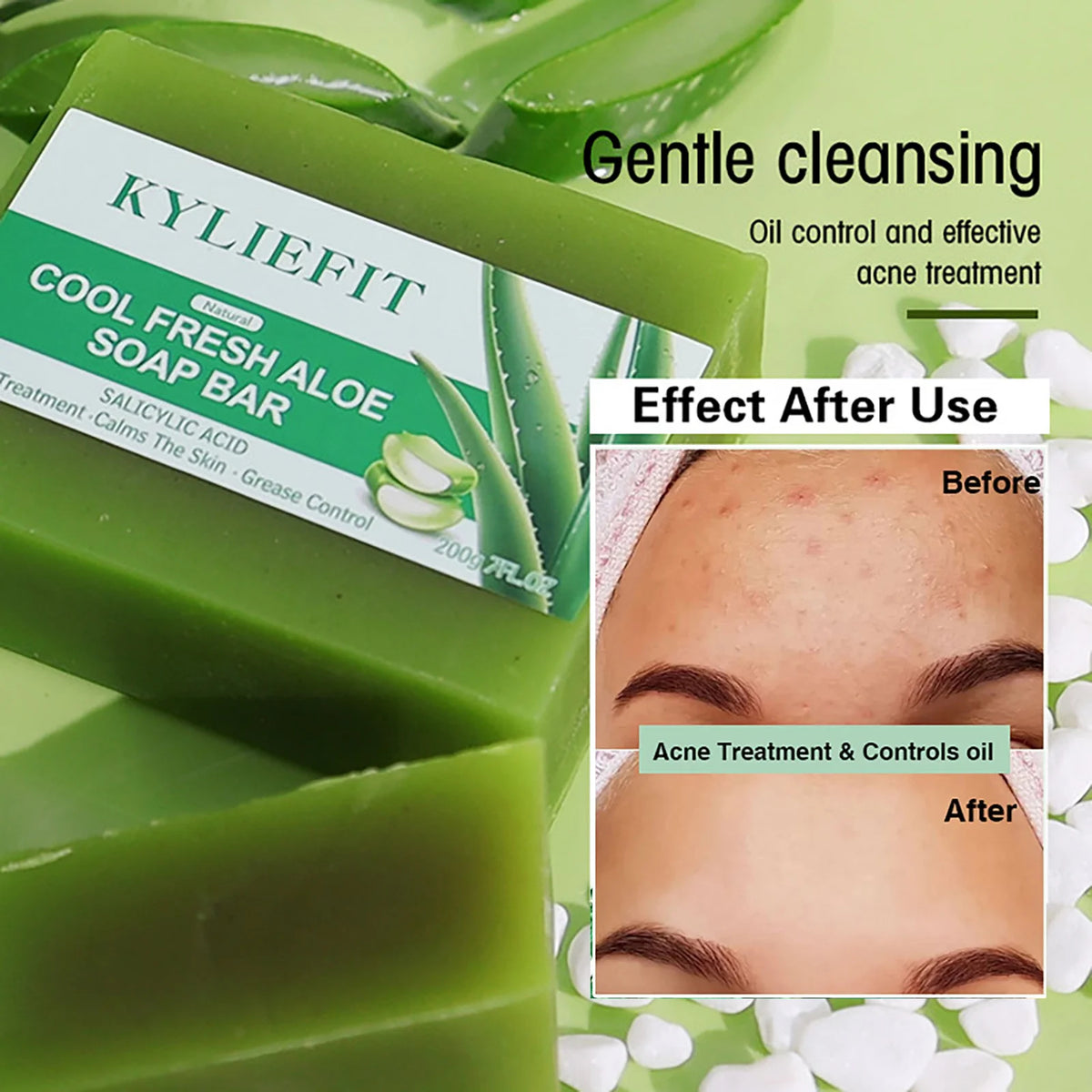 Aloe Brightening Soap Bar, Remove Dark Spots, Sun Spots, Acne, Oil Control, Clean Stains, Exfoliation, For Face and Body, 200g